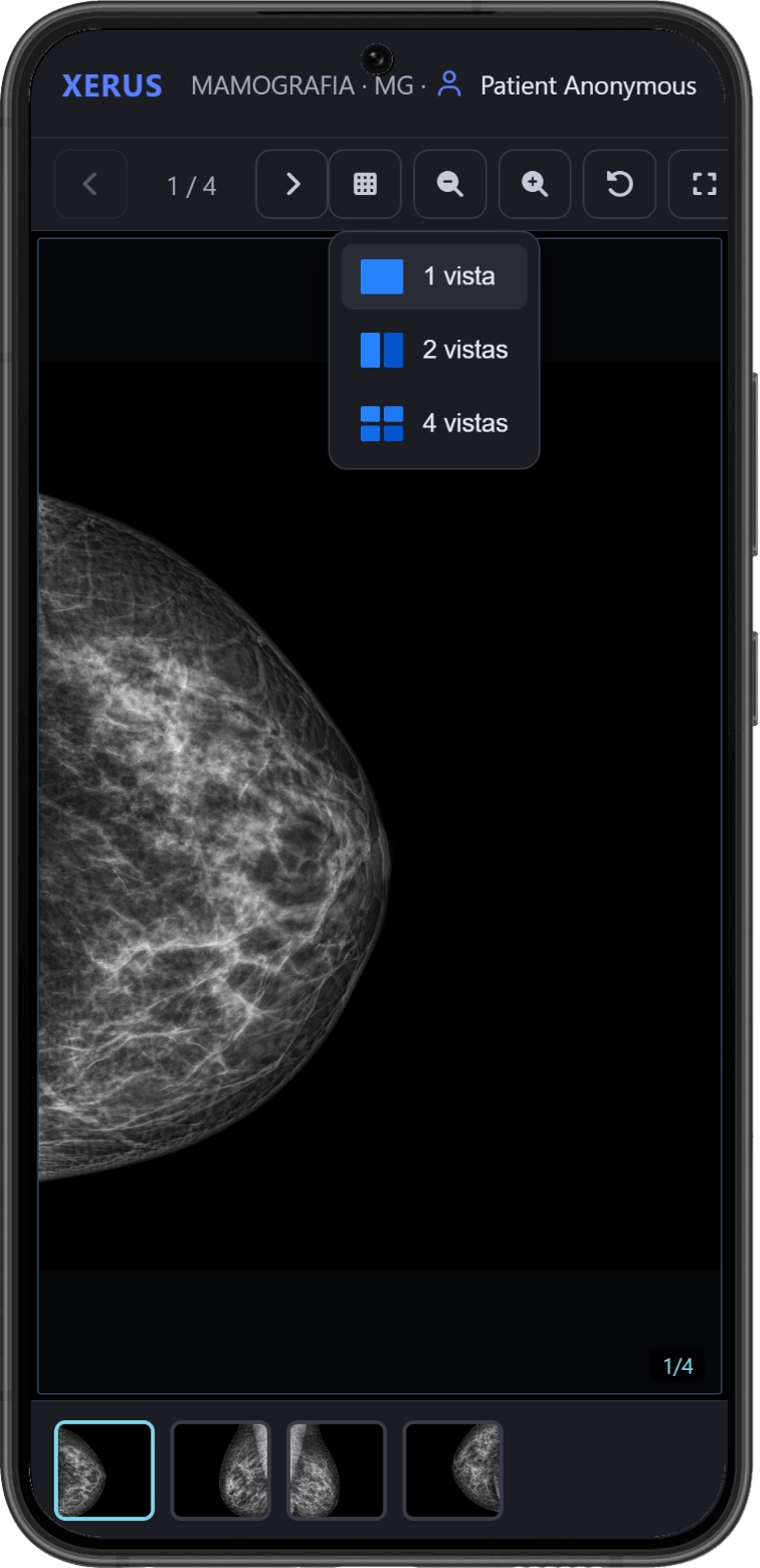 DICOM Viewer