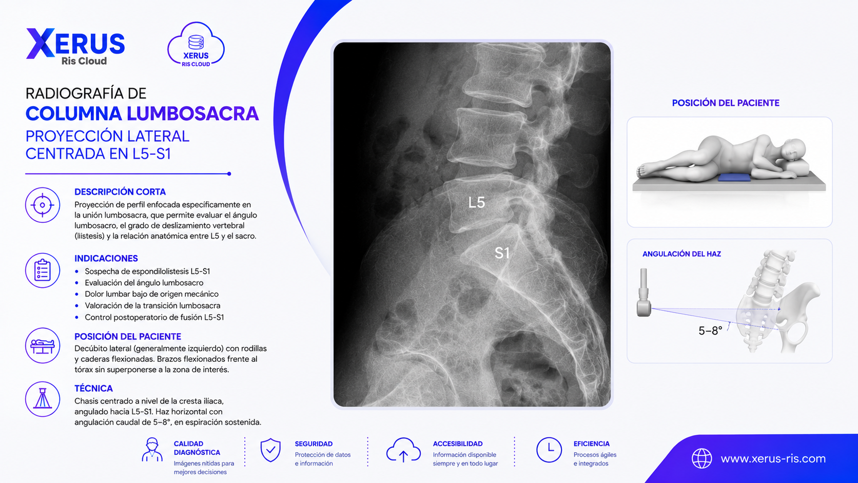 Radiografía de columna lumbosacra, proyección lateral centrada en L5-S1.
