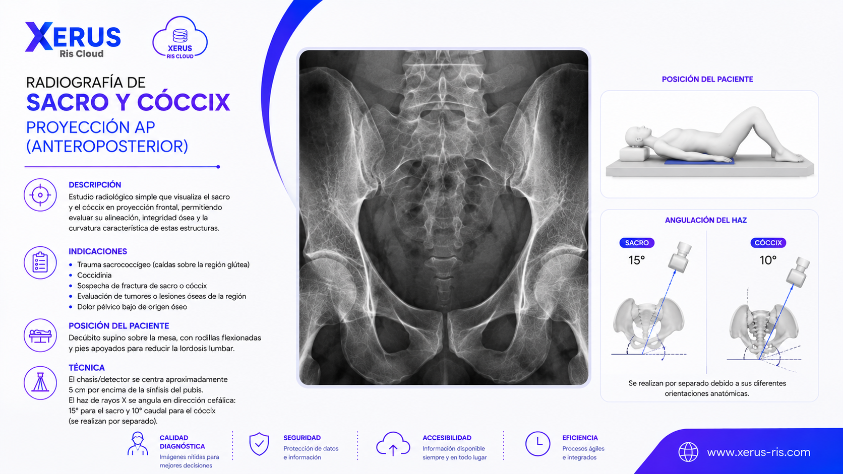 Radiografía de sacro y cóccix, proyección AP (anteroposterior).