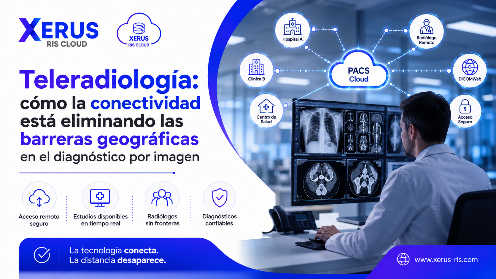 Teleradiología: cómo la conectividad está eliminando las barreras geográficas en el diagnóstico por imagen.
