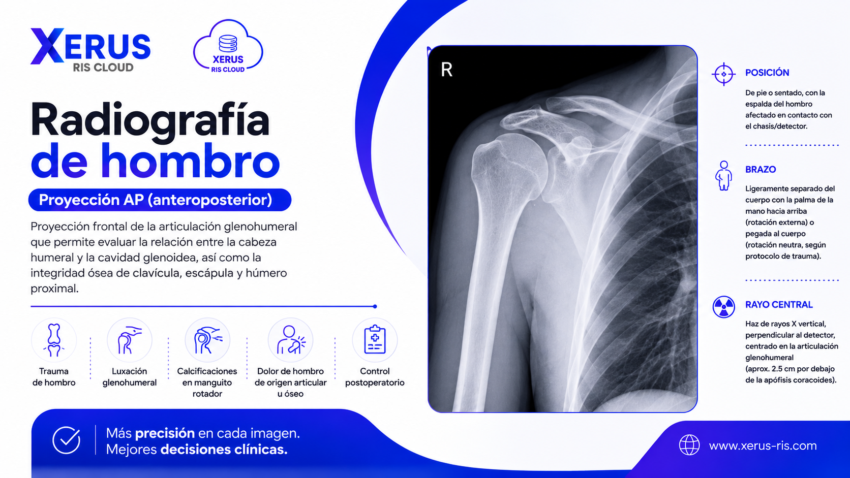 Radiografía de hombro, proyección AP (anteroposterior)
