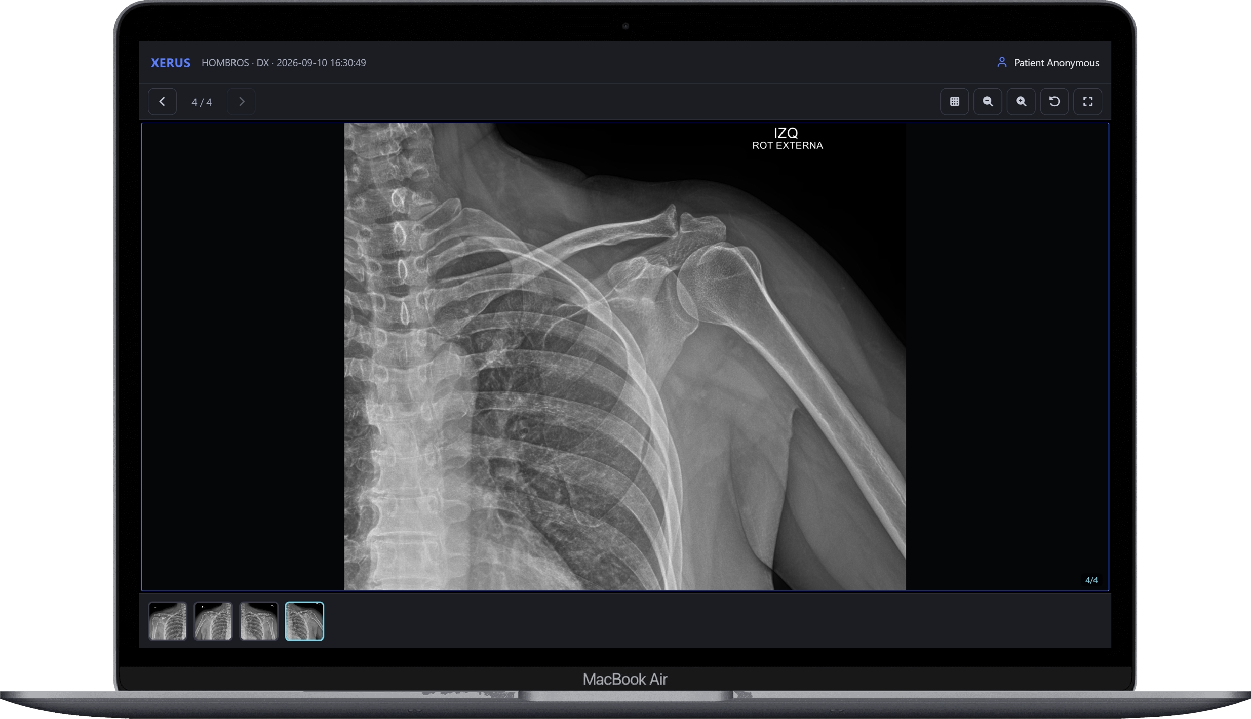 
                                        
                                        
                                        Software de Radiología Interoperable                                                                                                            